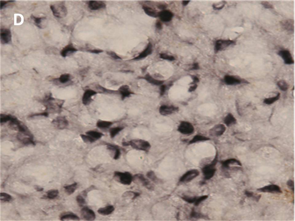 Estrogen receptorα-positive cells